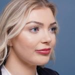 after rhinoplasty right angle view female patient case 798