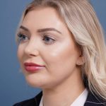 after rhinoplasty left angle view female patient case 798