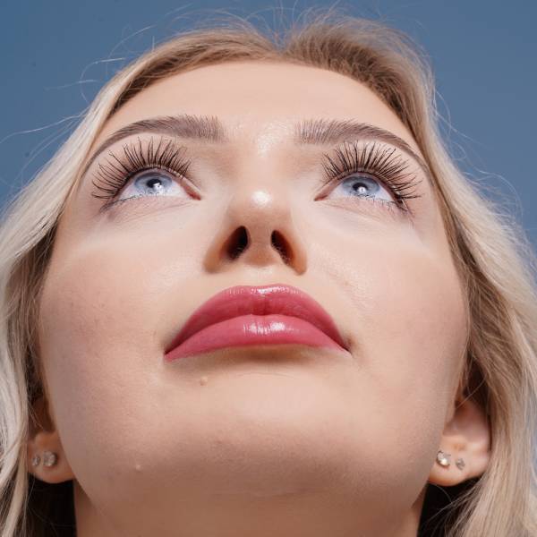 after rhinoplasty front head up view female patient case 798