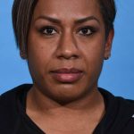 after rhinoplasty front view female patient case 1221