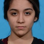 after rhinoplasty front view female patient case 1236